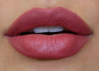 aumento de labios