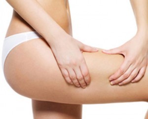 CELULITIS