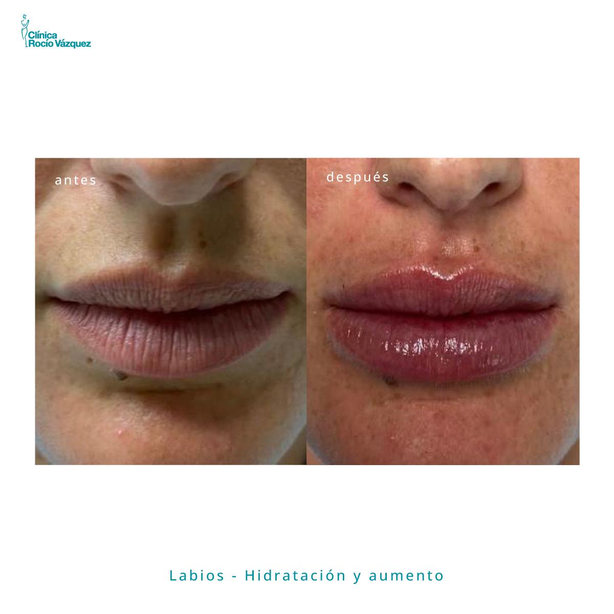 labios en sevilla