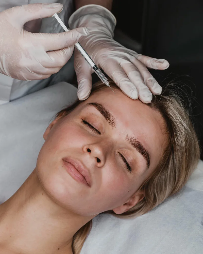 Tratamiento con botox para las lineas de expresion Sevilla